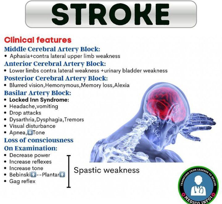 Stroke Medizzy