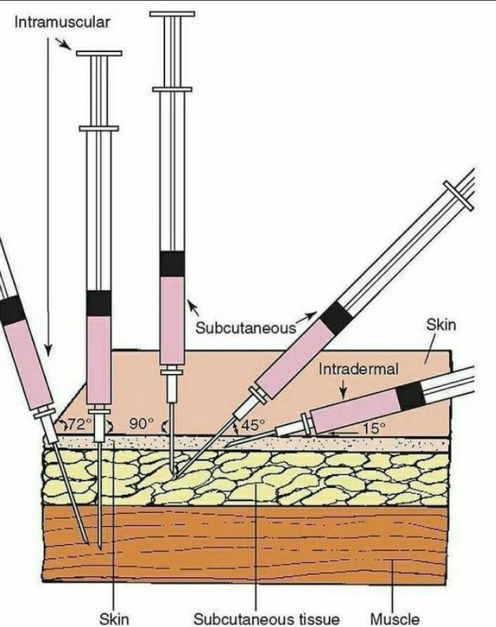 Types Of Injection MEDizzy