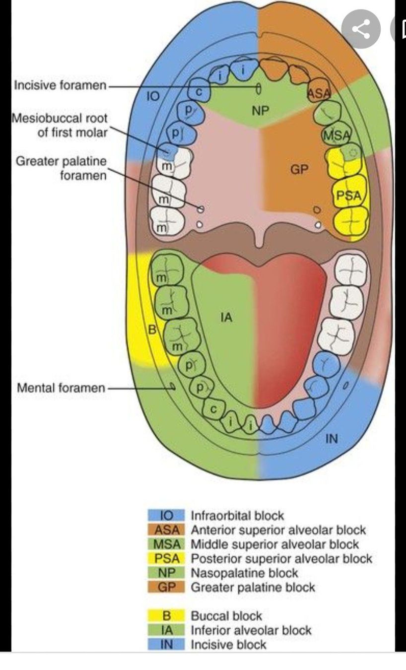 Nerve Blocks During Extraction Of Tooth Medizzy