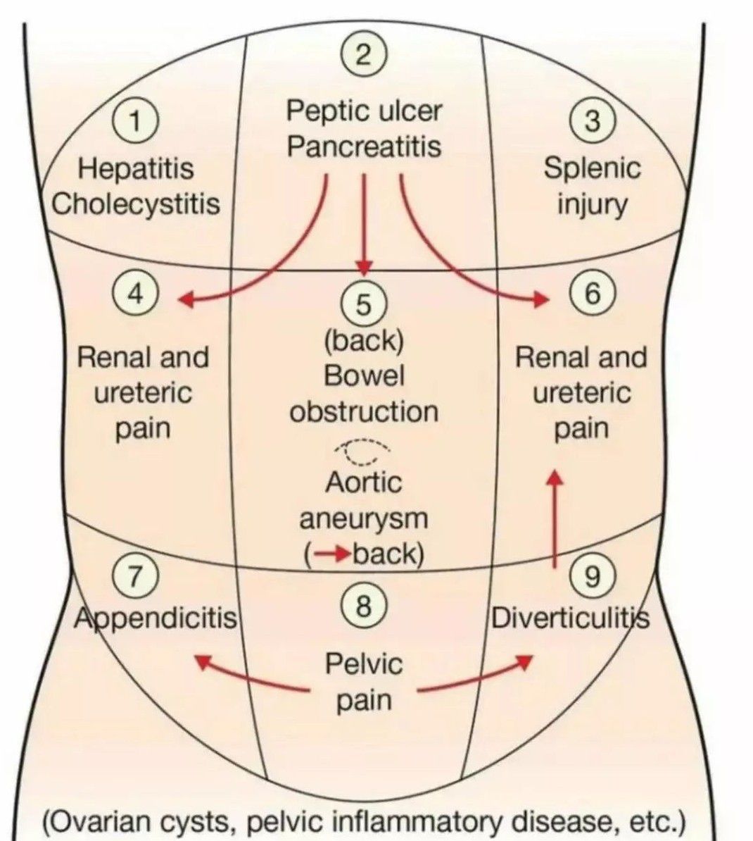 Abdominal Pain Dd Medizzy