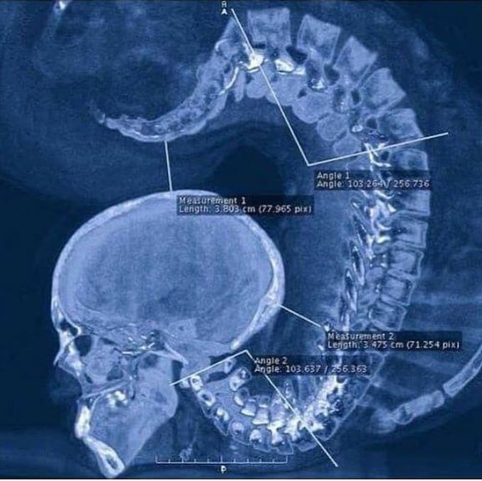 What You Re Looking At Is An X Ray Of An Individual A MEDizzy