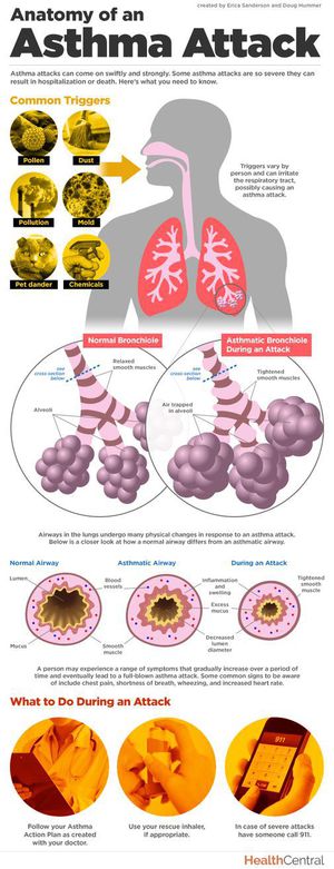 General Norms About Asthma Medizzy