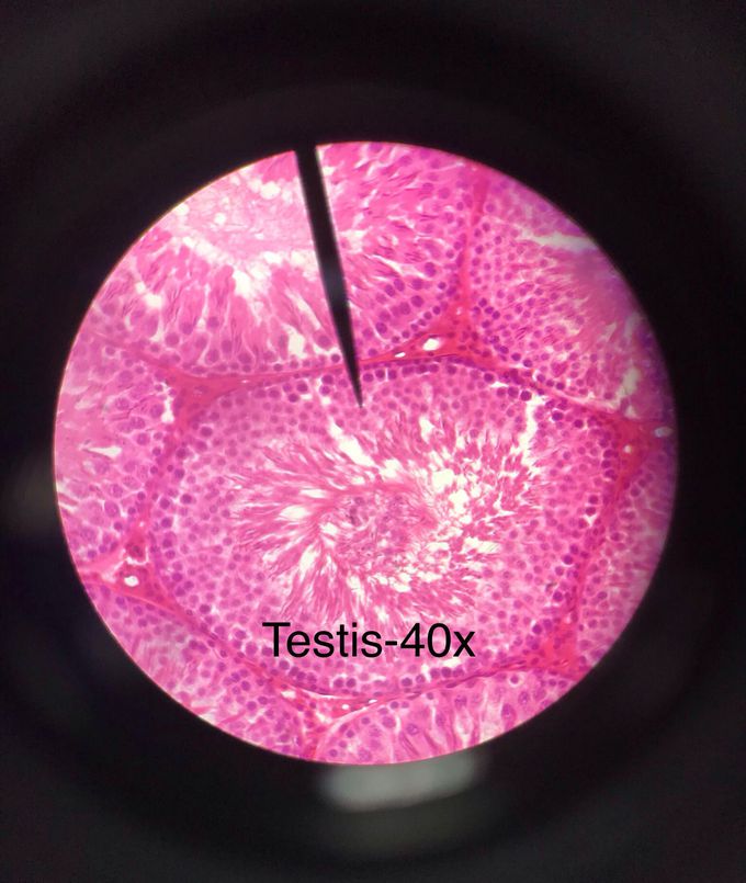 Histology of testis
