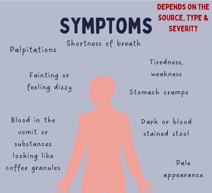 Upper GI Bleeding I