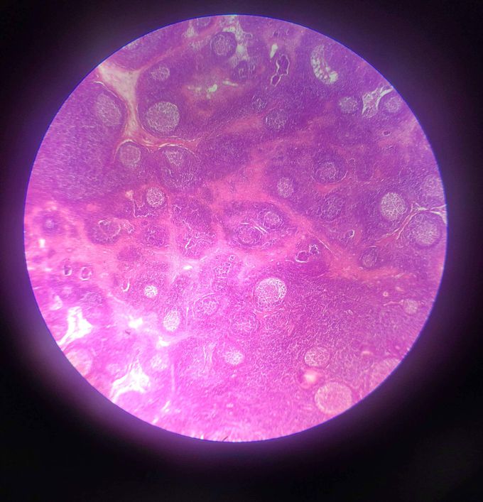 What do you think, which tissue is this?