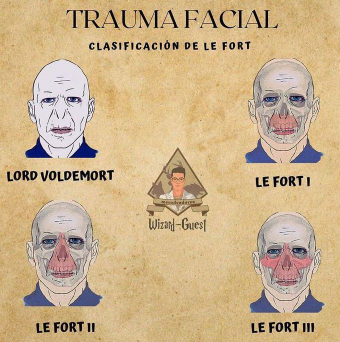 Le Forte Classification