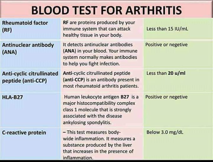 Blood test for arthritis MEDizzy