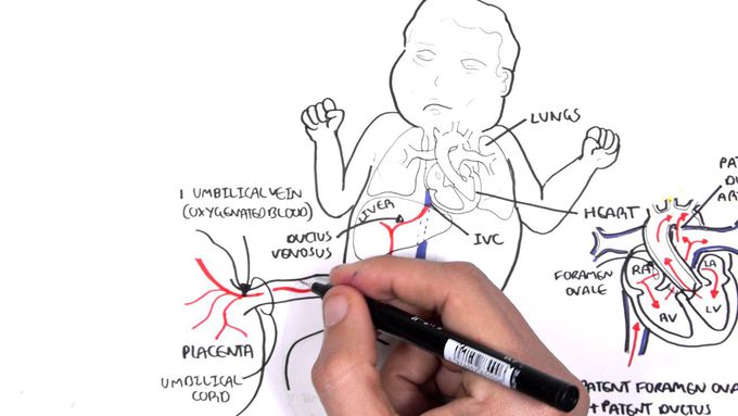 Fetal Circulation