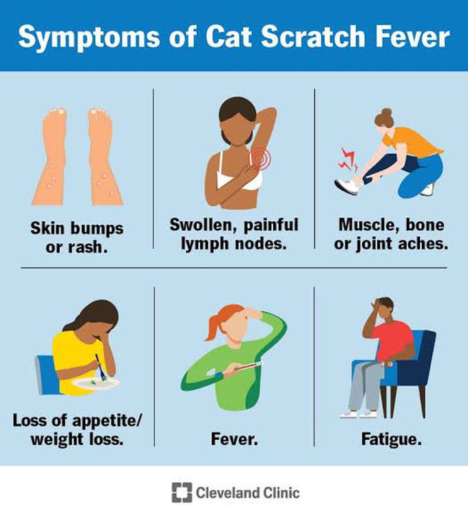 Symptoms of cat scratch disease