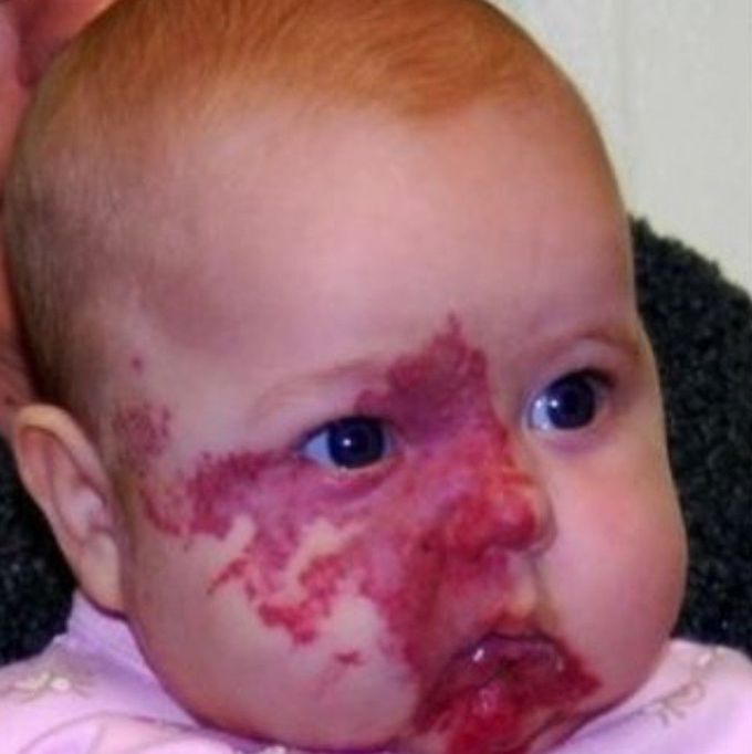 What is your diagnosis?