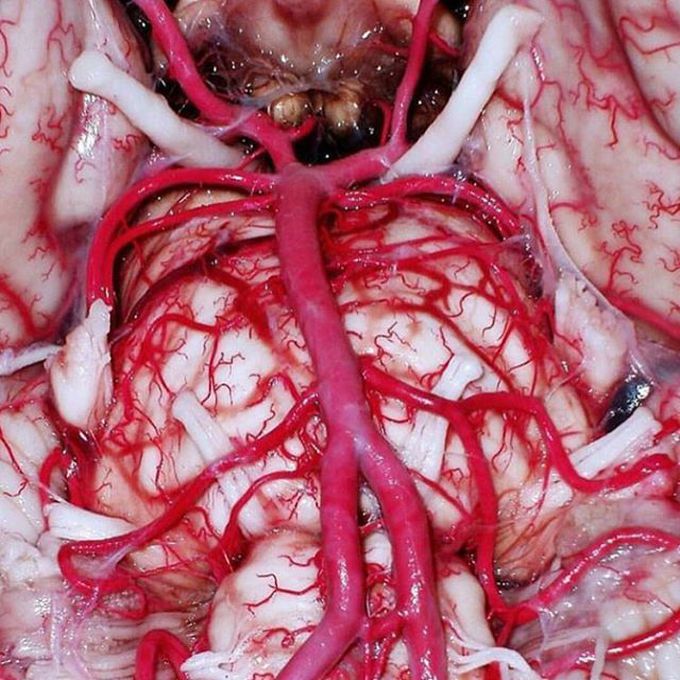 The circle of Willis is just showing off with its branches!  