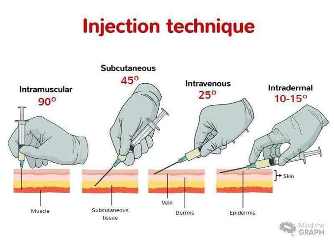 Type of injunction