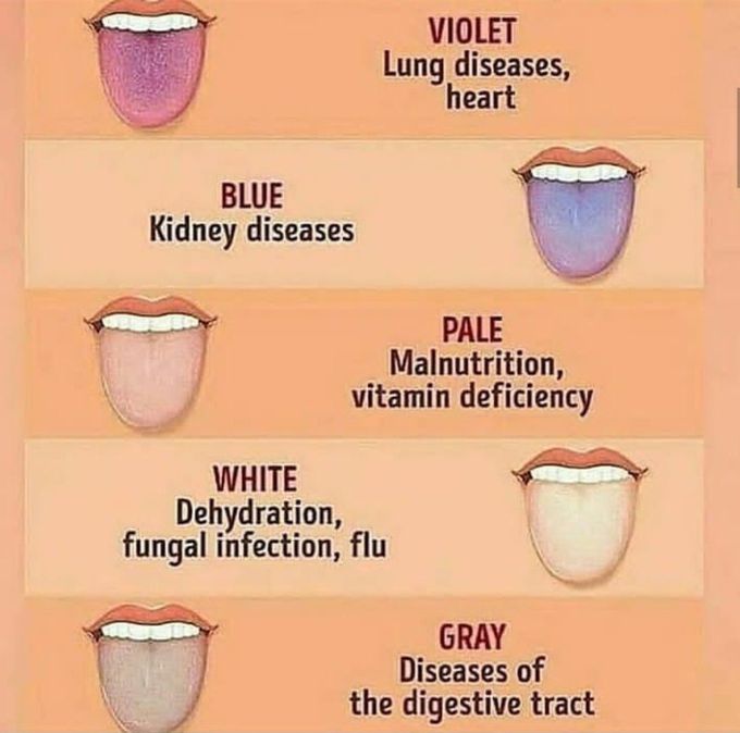 What Tongue colour tells us about our health?🤔👅