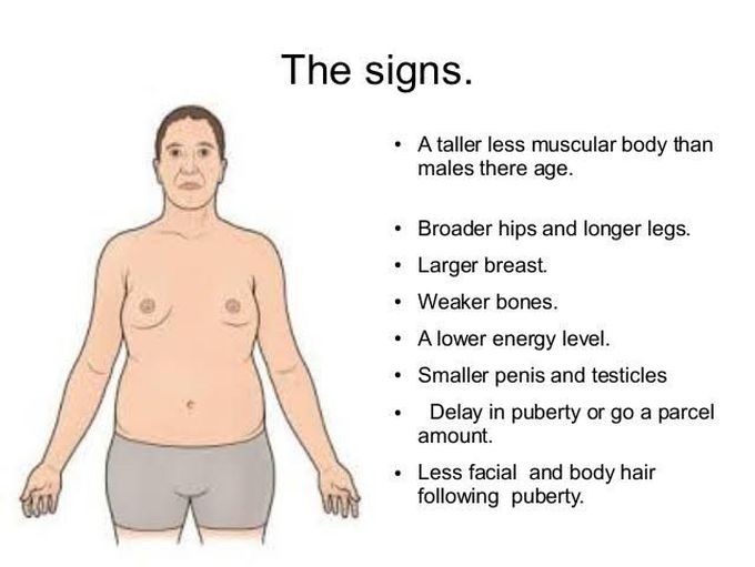 These Are The Symptoms Of Klinefelters Syndrome Medizzy