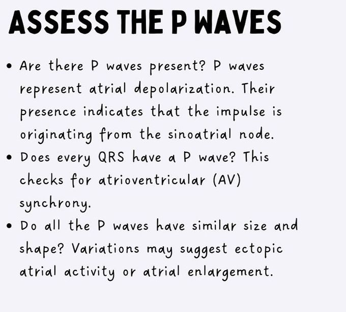 How to Read ECG- III