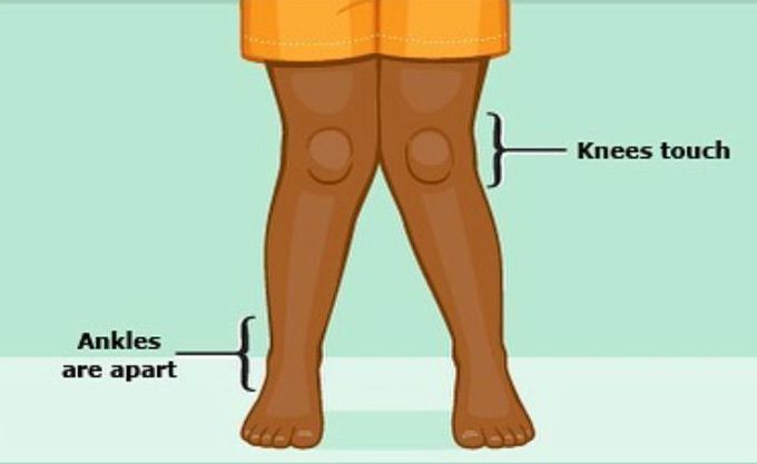 🔸 Guess the diagnosis !!