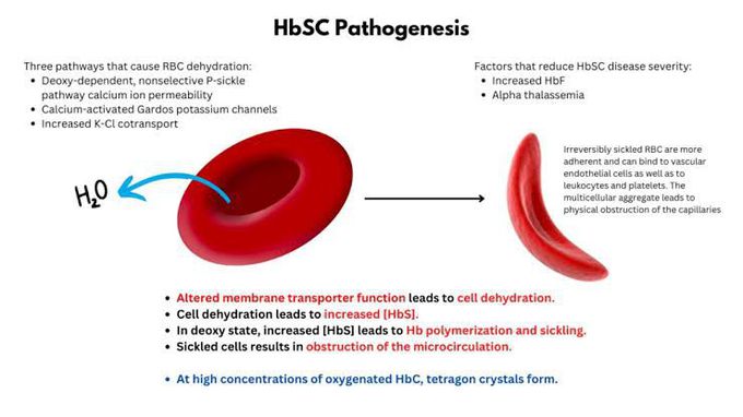 HbSC pathogenesis
