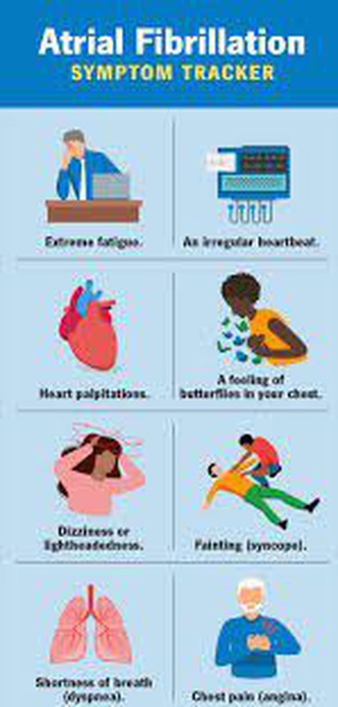 Symptoms of atrial fibrillation