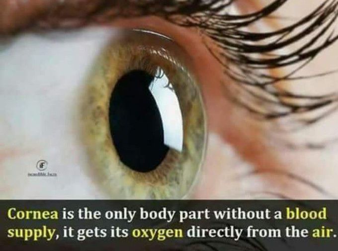 True