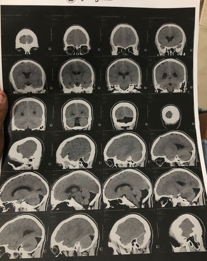 diagnosis