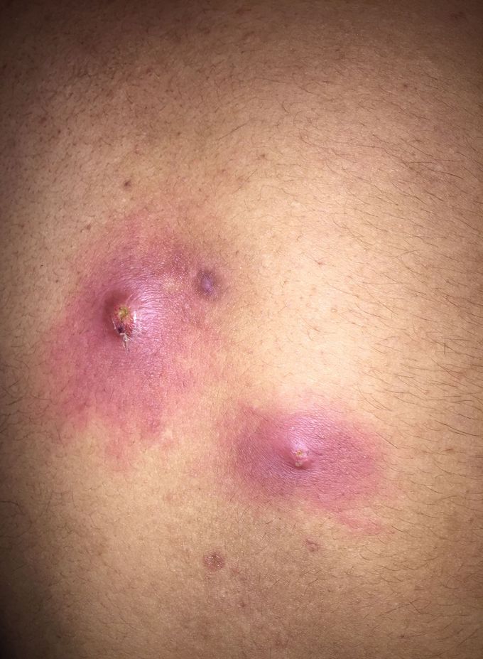 What is this and suggest treatment