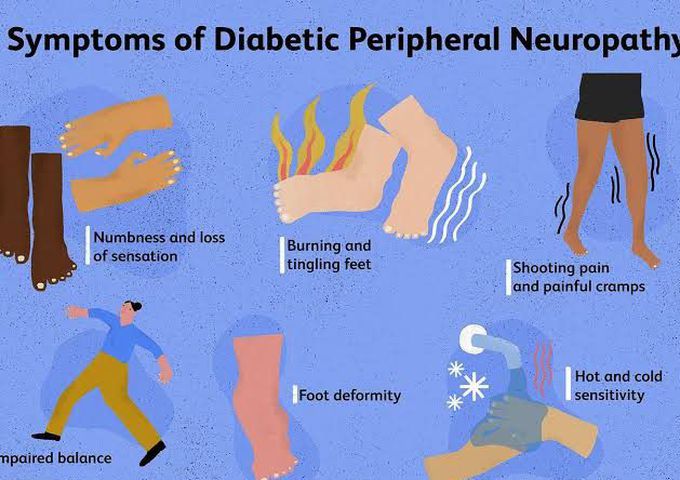 Peripheral neuropathy