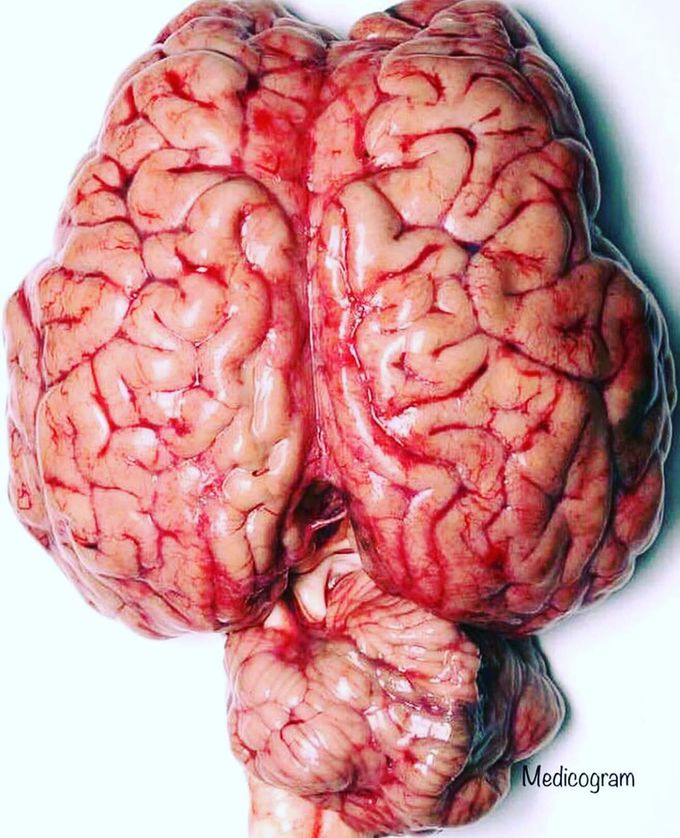 Human brain 