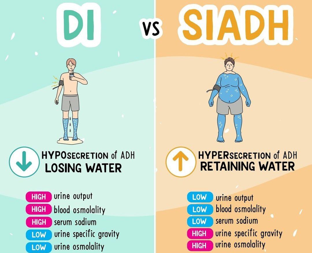 DI Vs SIADH - MEDizzy