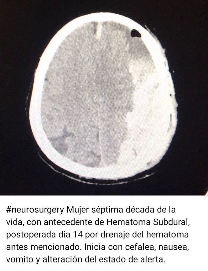 Neurosurgery