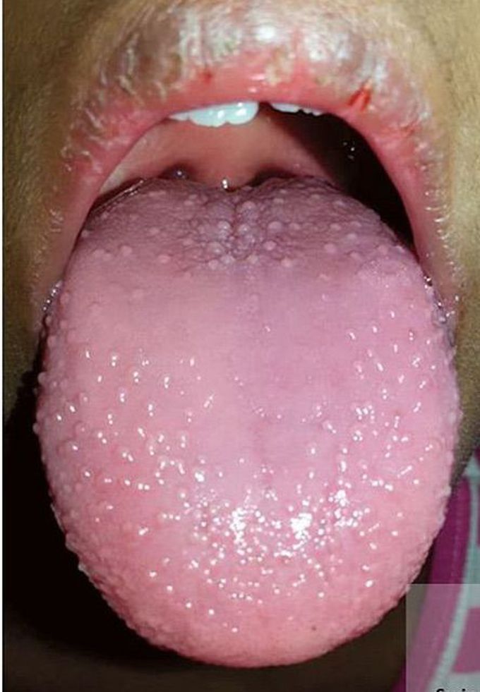 What is your diagnosis??
