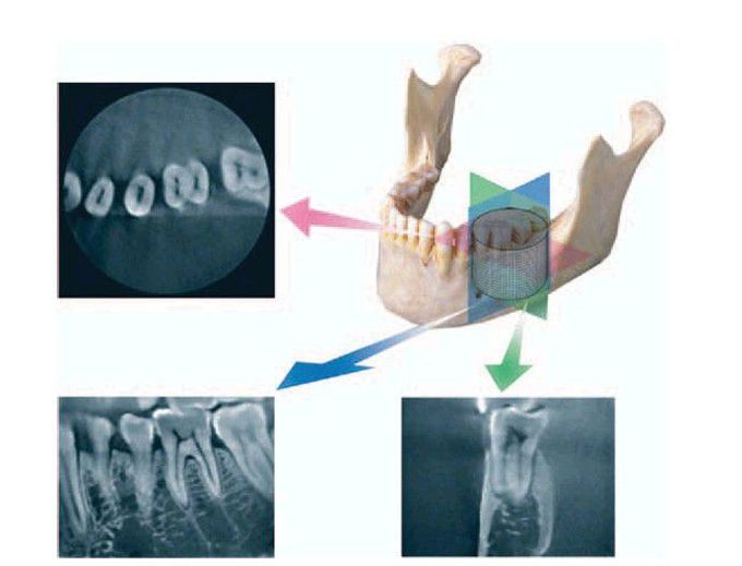 CBCT advantage