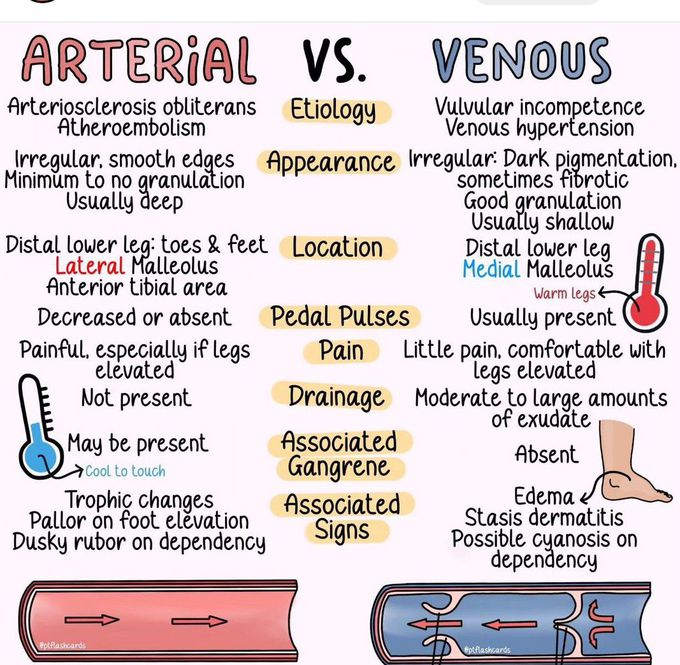 Arterial Vs Venous