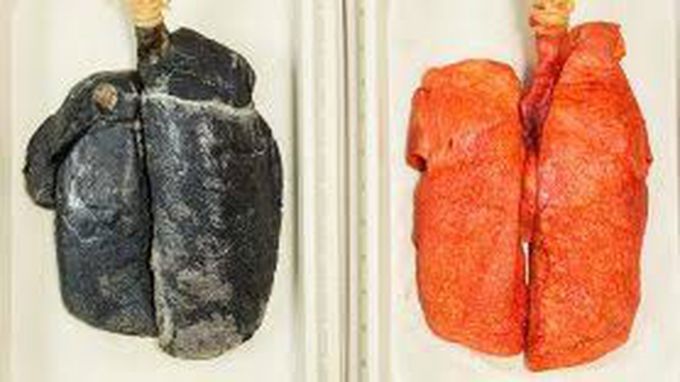 Smoker's vs healthy lungs