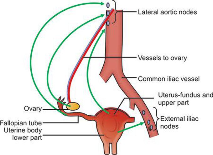 This is how lymphatic drainage of ovary looks like!