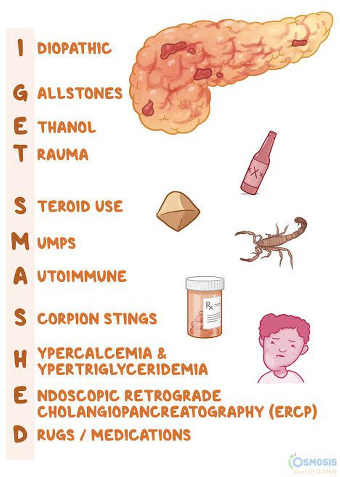 Causes of acute pancreatitis