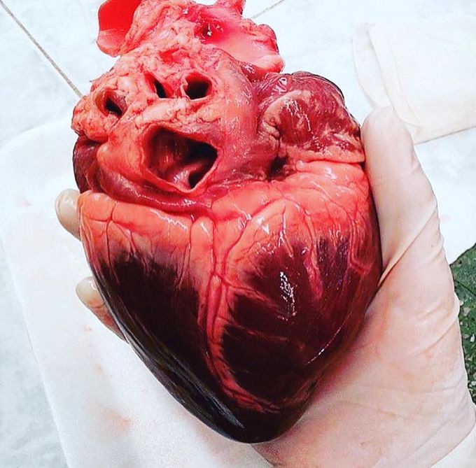 The Heart