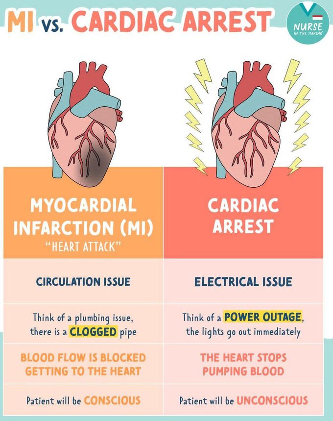 MI Vs Cardiac Arrest