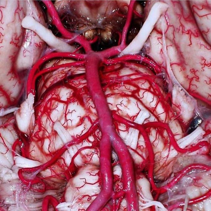 Circle of willis  