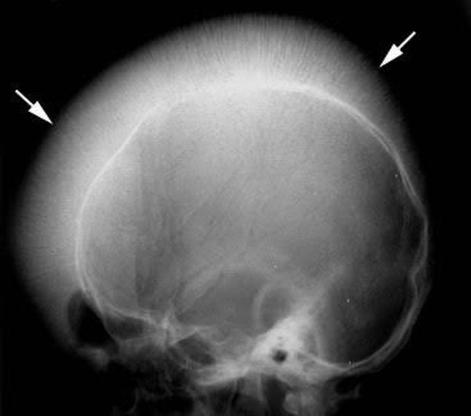 Hair on end sign