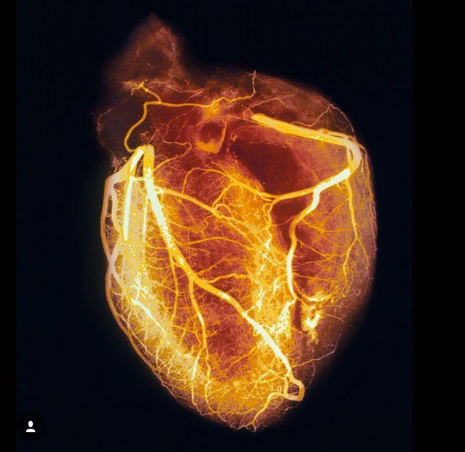 Heart