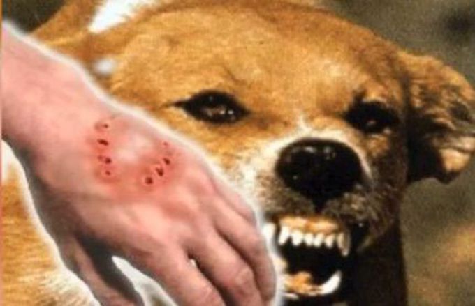 Rabies