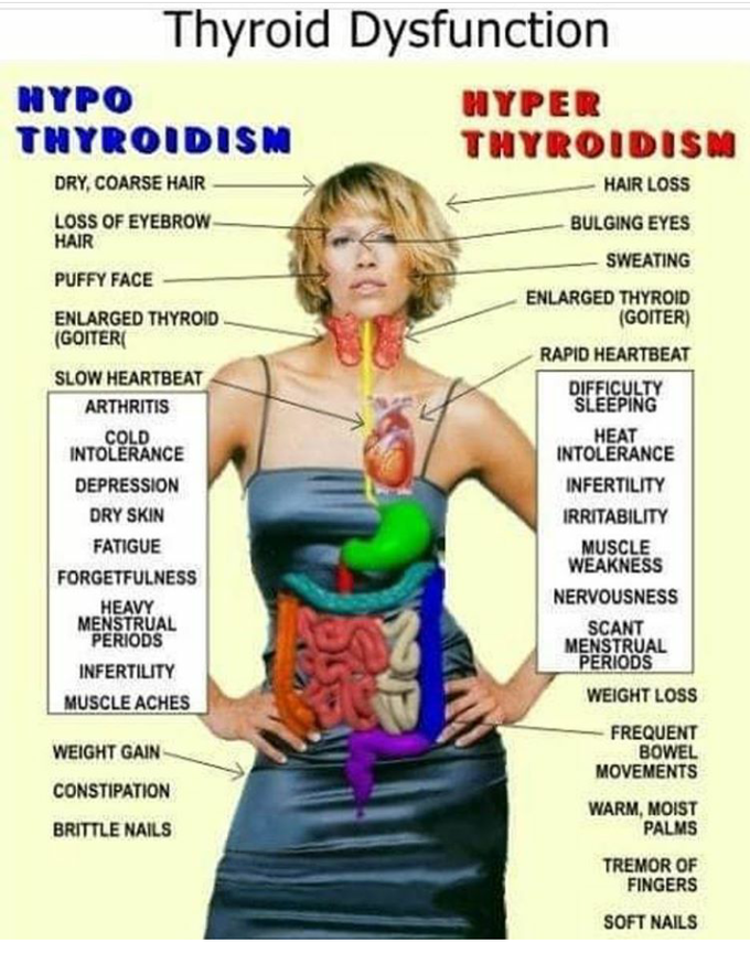 Thyroid dysfunction