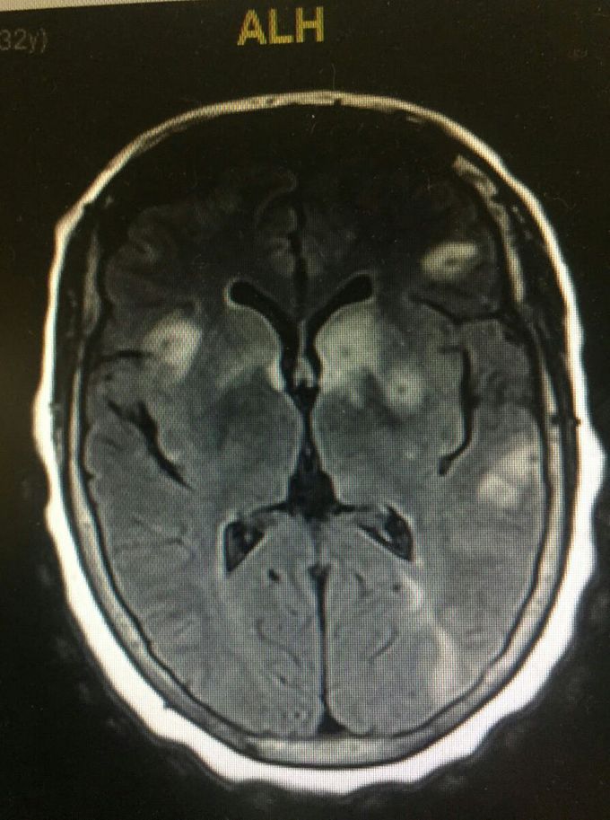 Diagnosis?
