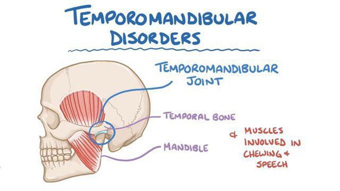 Cause of TMJ pain Disorders