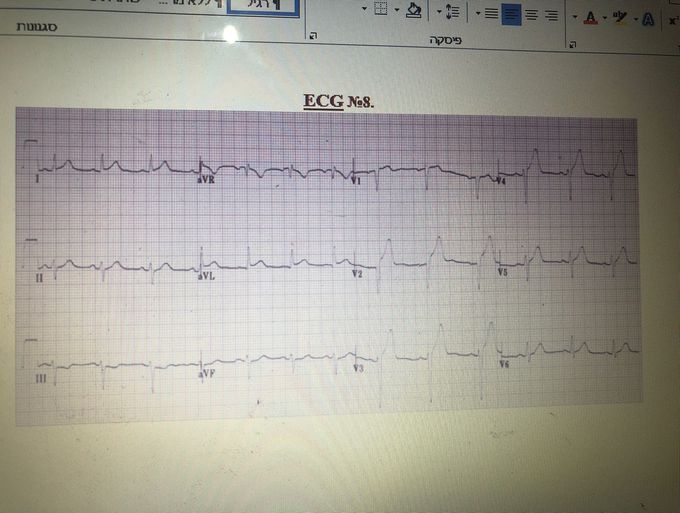 Hello any body can help with this ecg nAme?
