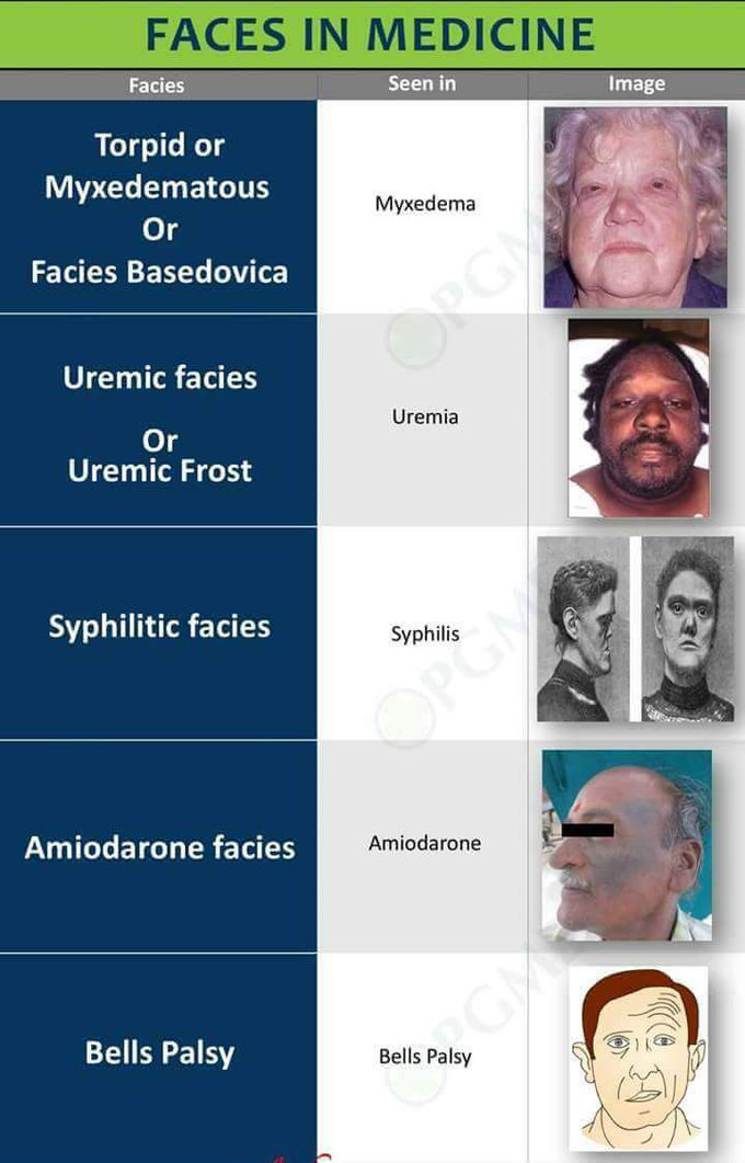 Different facies in medicine