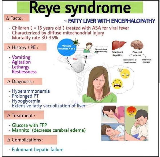 Reye Syndrome