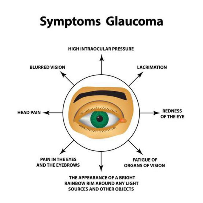 Symptoms of glaucoma