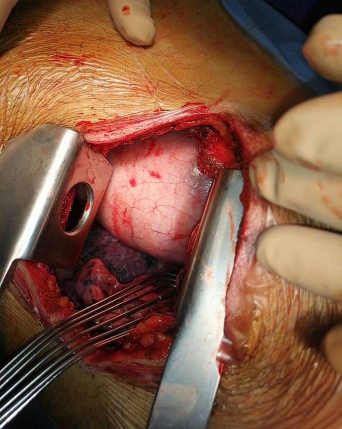 Emergency case 