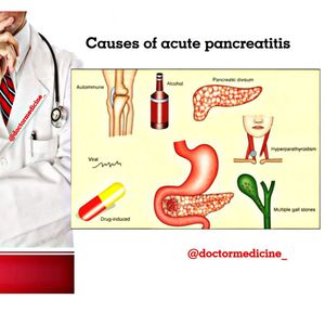 Causes if acute Pancreatitis - MEDizzy